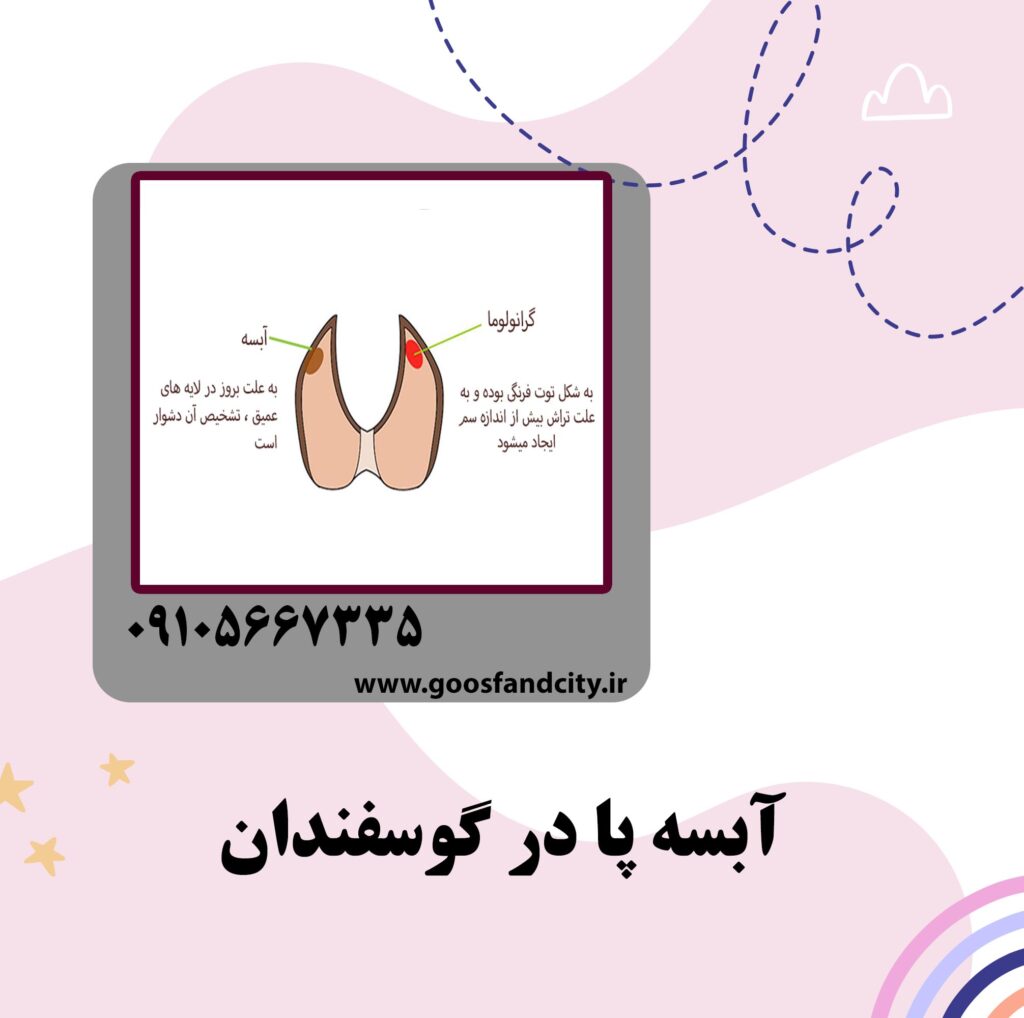 آبسه پا در گوسفندان